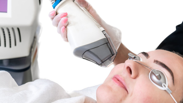 Close up image of a female patient getting fraxel laser treatment 
